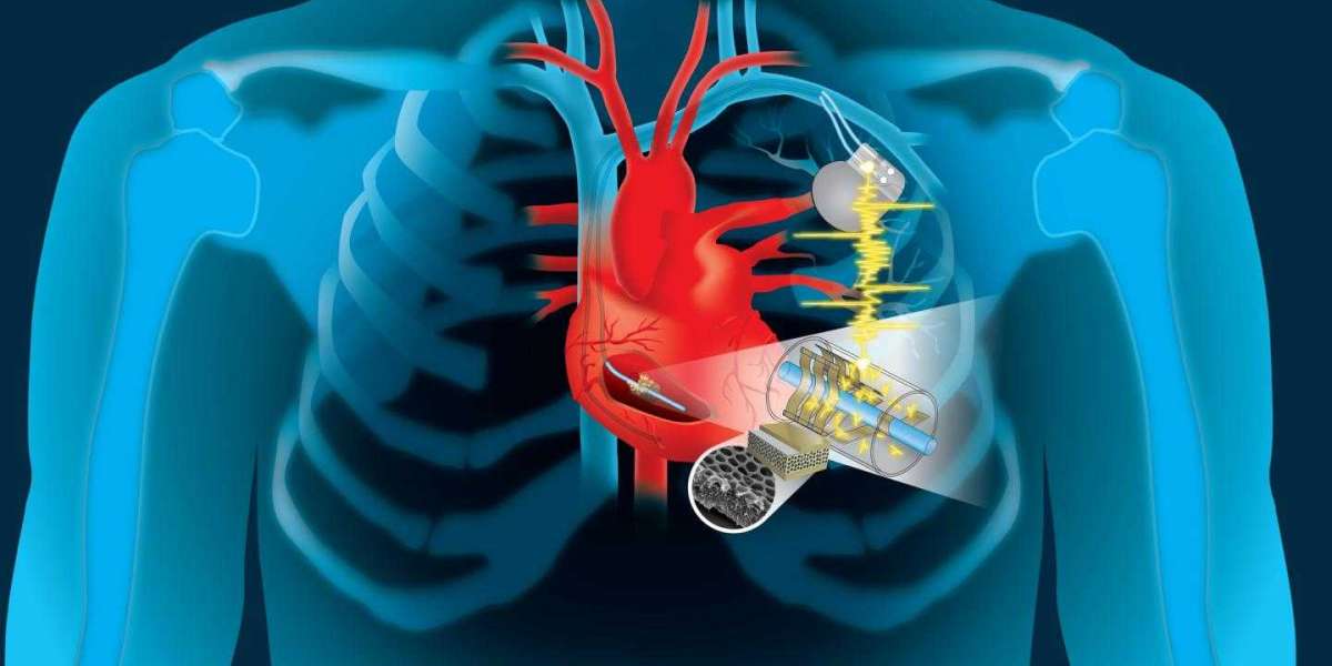 Favorable Reimbursement Policies Set to Augment Cardiac Implants Market